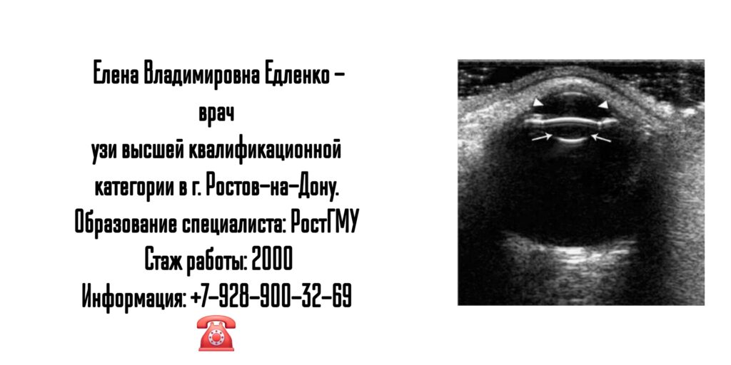 Елена Владимировна Едленко - врач УЗИ в Ростове-на-Дону