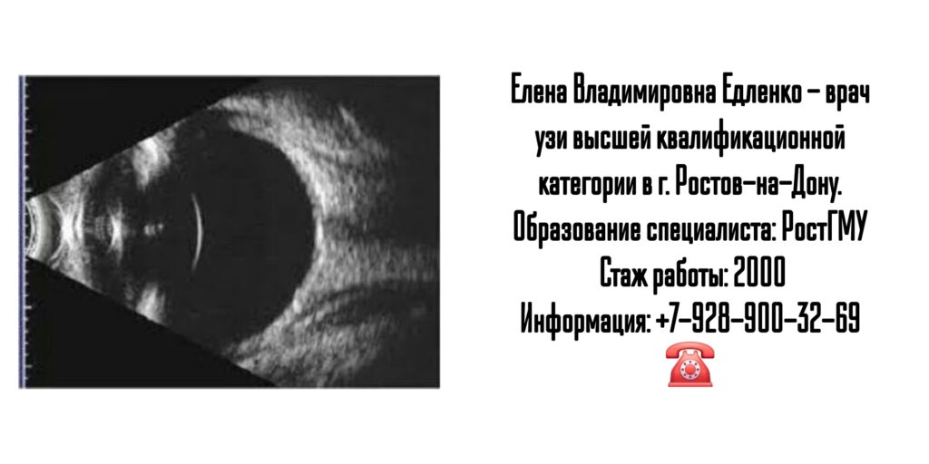 Елена Владимировна Едленко - врач УЗИ в Ростове-на-Дону