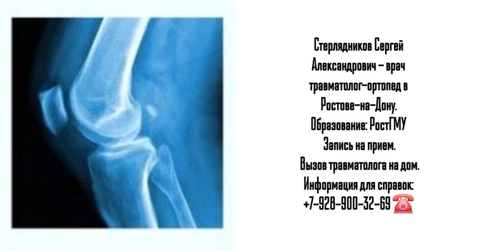 Сергей Александрович Стерлядников - ортопед-травматолог в Ростове-на-Дону 