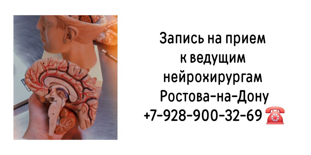 Ростов консультация у лучших нейрохирургов 