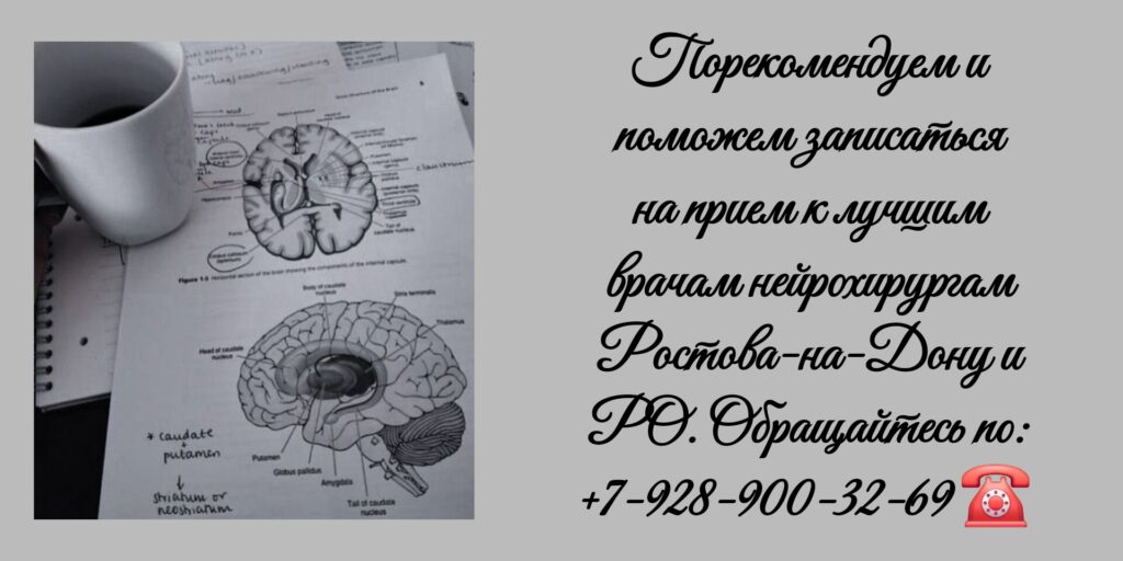 Ростов консультация у лучших нейрохирургов 