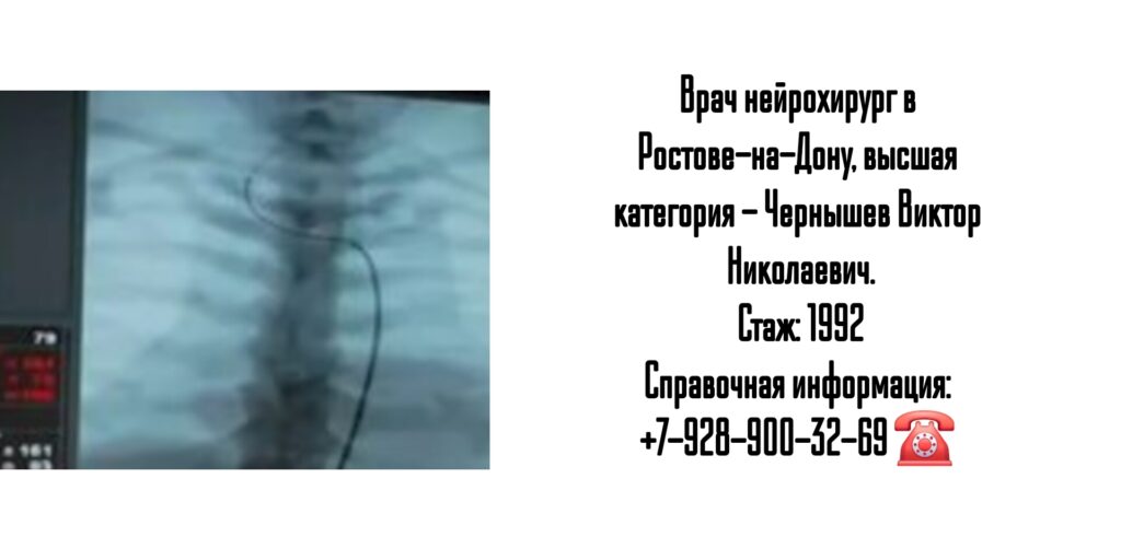 Ростов ведущий нейрохирург - Чернышев В.Н.