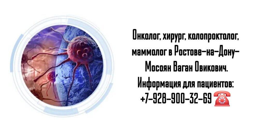 Мосоян Ваган Овикович - онколог Ростов