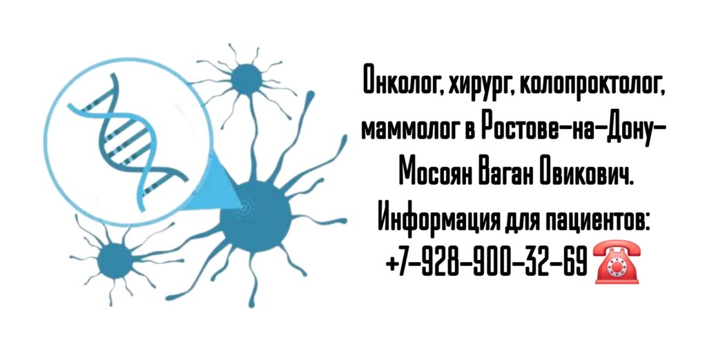 Мосоян Ваган Овикович - онколог Ростов