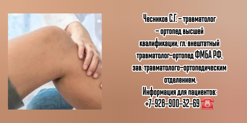 Ростов травматолог - ортопед - Чесников Сергей Геннадьевич
