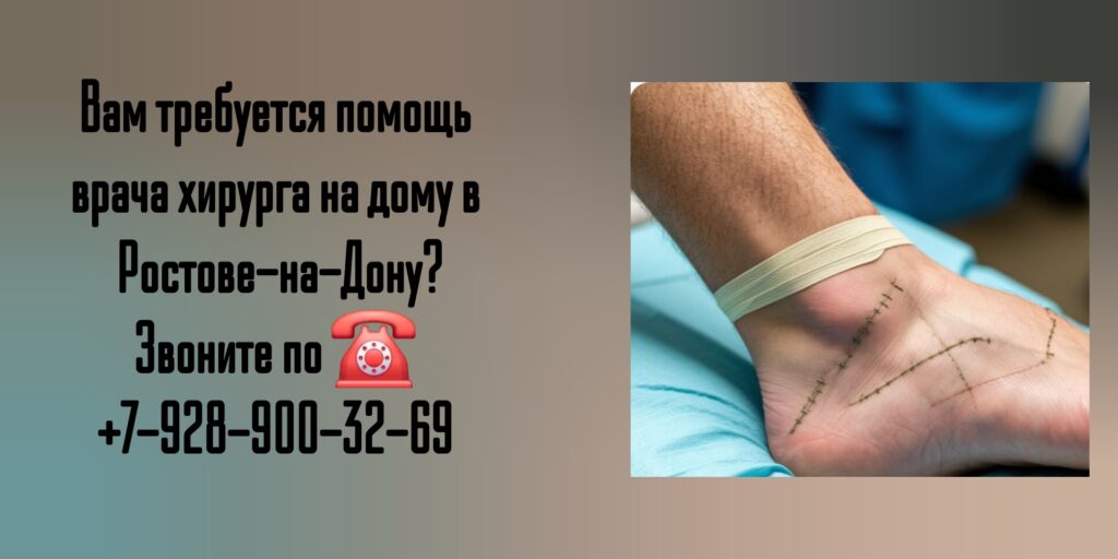 Вызов хирурга на дом в Ростове-на-Дону 