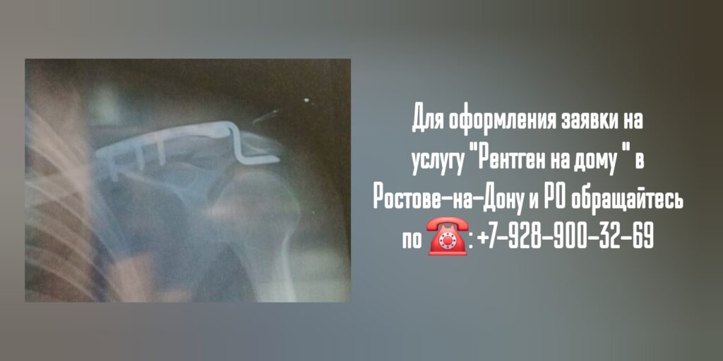 Ростов Рентген на дому - вызов на дом врача