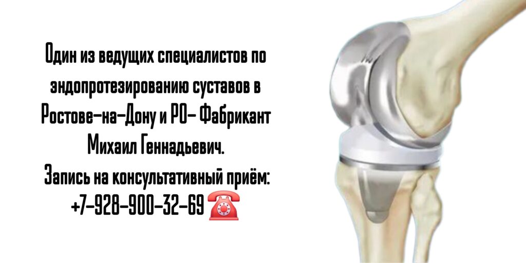 Эндопротезирование суставов- Фабрикант Михаил Геннадьевич