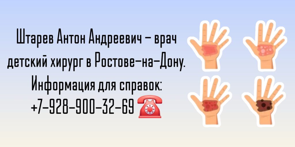 Ростов детский ожоговый хирург - Антон Андреевич Штарев 