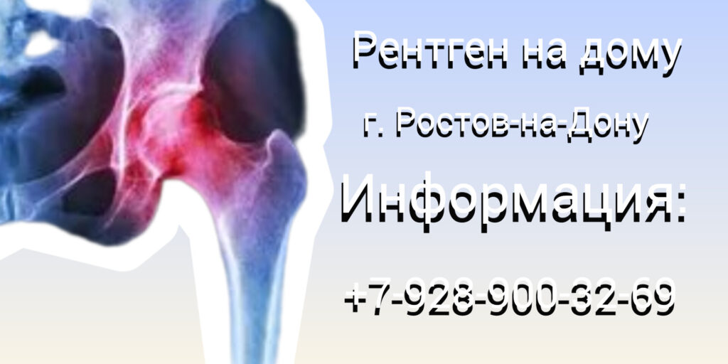 Ростов-на-Дону Рентген на дому: комфорт и удобство диагностики