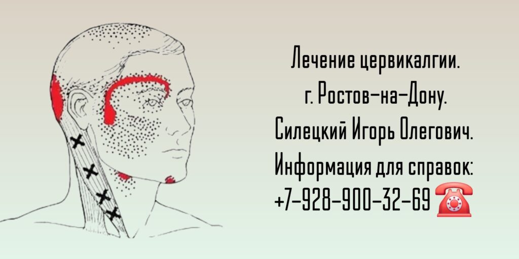 Цервикалгия - лечение в Ростове-на-Дону - Силецкий Игорь Олегович 