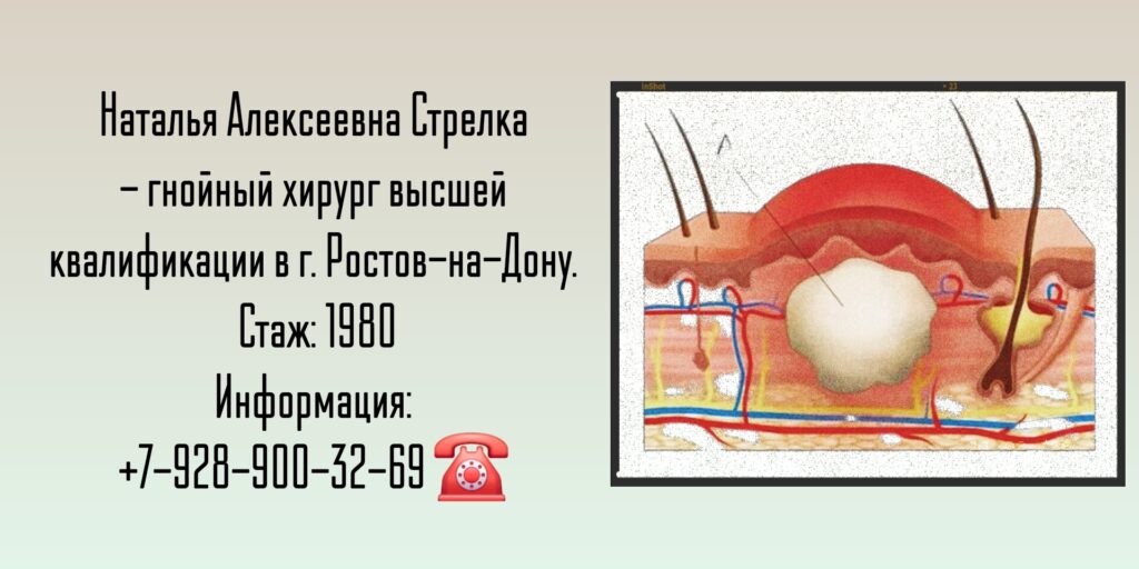 Стрелка Наталья Алексеевна - гнойный хирург Ростов-на-Дону