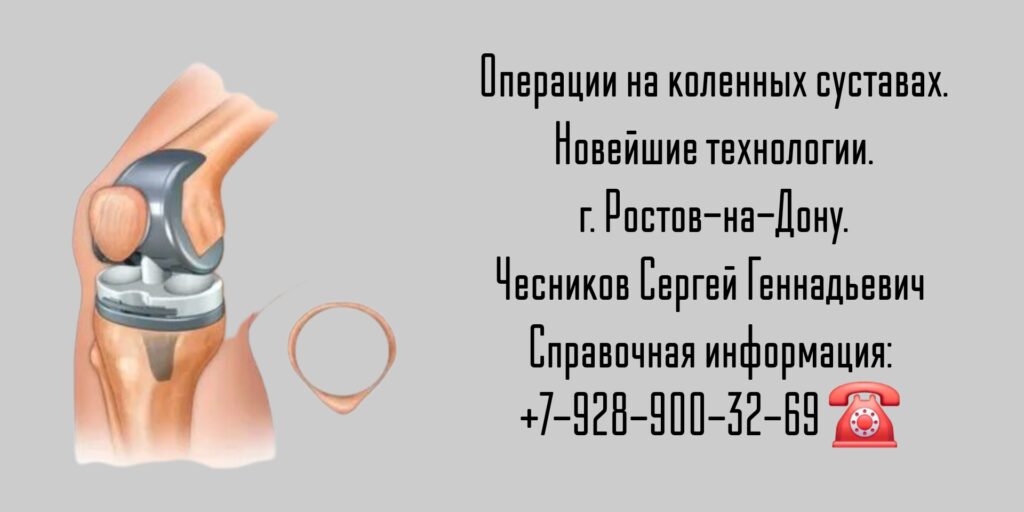 Чесников Сергей Геннадьевич - операции на коленных суставах - Ростов-на-Дону