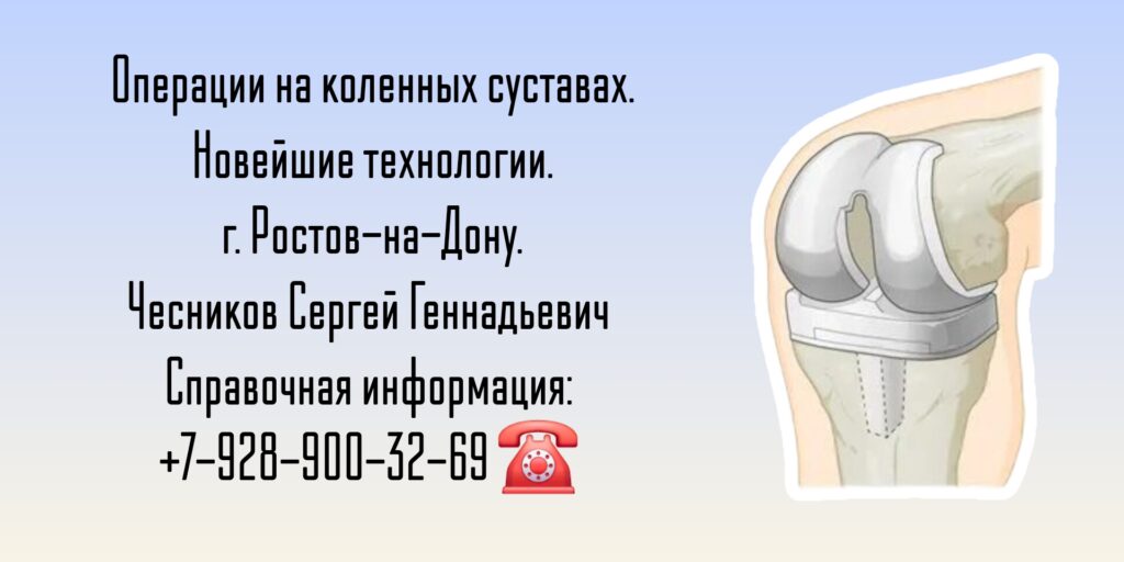 Чесников Сергей Геннадьевич - операции на коленных суставах - Ростов-на-Дону