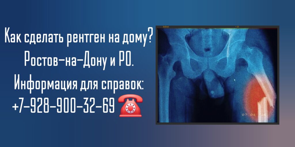 Рентген тазобедренного сустава на дому в Новочеркасске