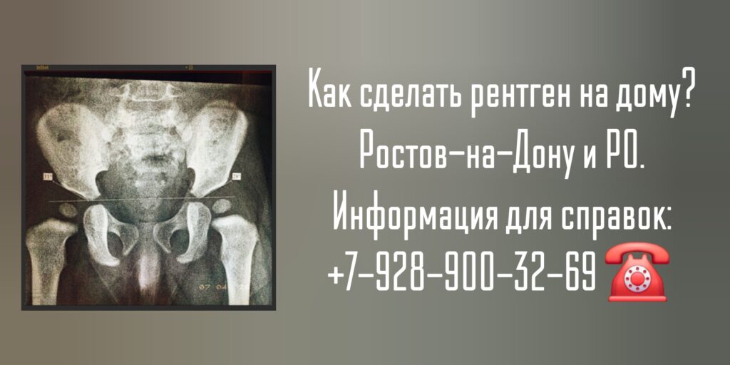 Рентген тазобедренного сустава на дому в Новочеркасске