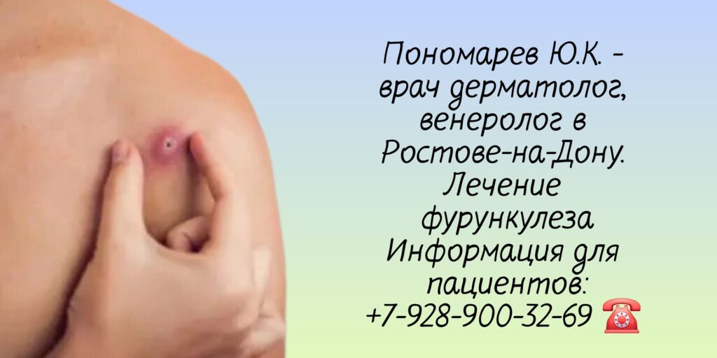 Лечение фурункулеза в Ростове-на-Дону- Пономарев Юрий Константинович