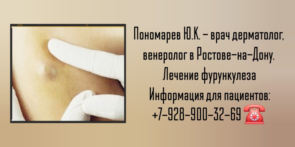 Лечение фурункулеза в Ростове-на-Дону- Пономарев Юрий Константинович