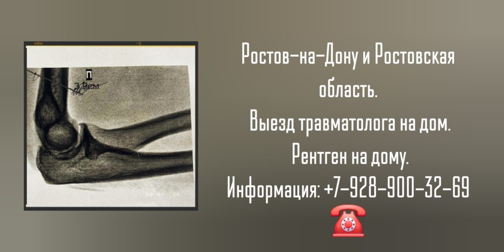Ростов Вызов травматолога на дом - рентген на дому