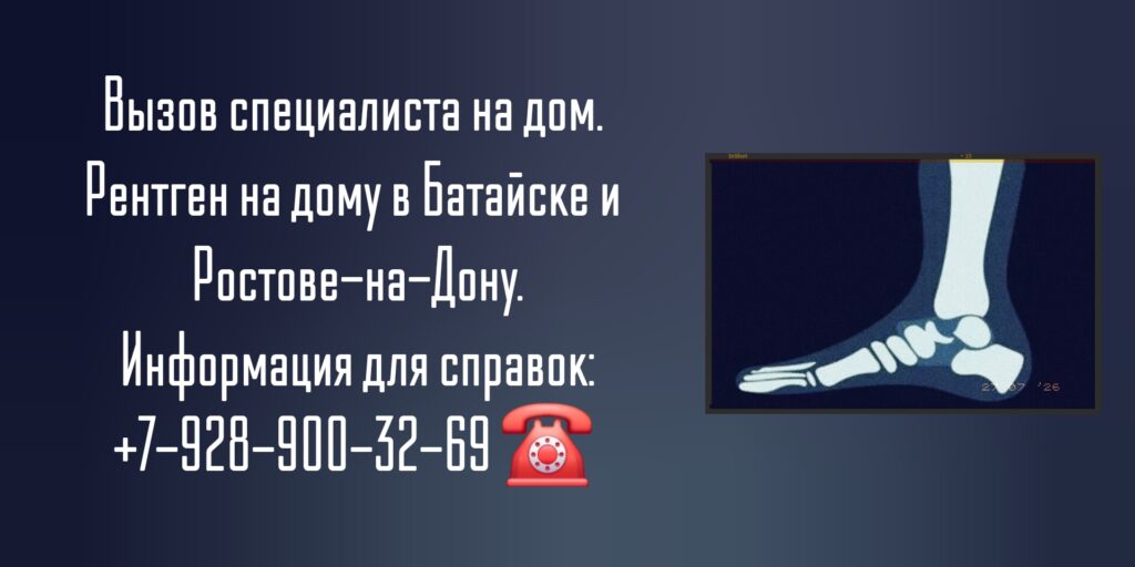 Батайск рентген на дому 