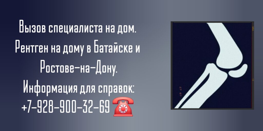 Батайск рентген на дому 